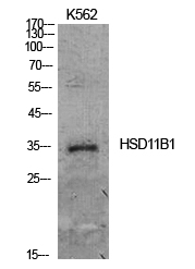 Fig.1. Western Blot analysis of K562 cells using 11β-HSD1 Polyclonal Antibody. Antibody was diluted at 1:500. Secondary antibody (catalog#: A21020) was diluted at 1:20000.