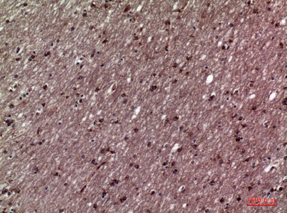 Fig.4. Immunohistochemical analysis of paraffin-embedded human-brain, antibody was diluted at 1:100.