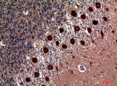 Fig.5. Immunohistochemical analysis of paraffin-embedded human-brain, antibody was diluted at 1:100.