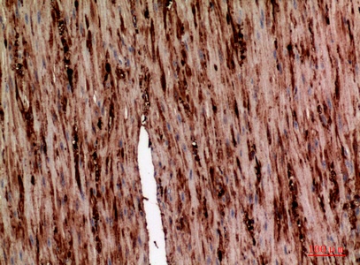Fig.2. Immunohistochemical analysis of paraffin-embedded human-colon, antibody was diluted at 1:100.
