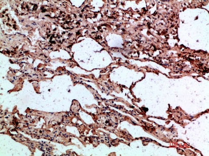Fig.3. Immunohistochemical analysis of paraffin-embedded human-lung, antibody was diluted at 1:200.