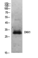 Fig.1. Western Blot analysis of hela cells using Dkk-1 Polyclonal Antibody. Secondary antibody (catalog#: A21020) was diluted at 1:20000.