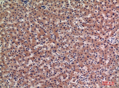 Fig.2. Immunohistochemical analysis of paraffin-embedded human-liver, antibody was diluted at 1:100.