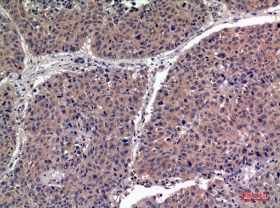 Fig.3. Immunohistochemical analysis of paraffin-embedded human-lung, antibody was diluted at 1:100.