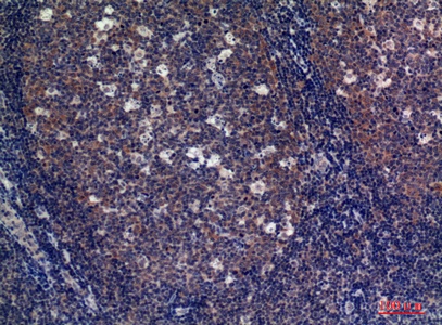 Fig.2. Immunohistochemical analysis of paraffin-embedded human-tonsils, antibody was diluted at 1:100.
