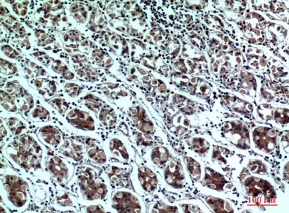 Fig.4. Immunohistochemical analysis of paraffin-embedded human-stomach, antibody was diluted at 1:100.