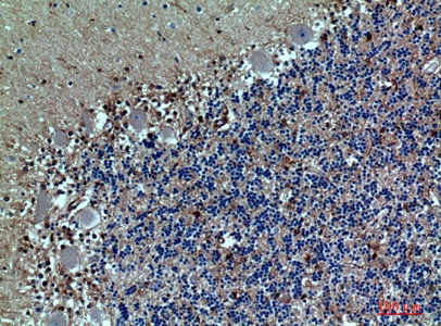 Fig.3. Immunohistochemical analysis of paraffin-embedded human-brain, antibody was diluted at 1:100.