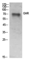 Fig. Western Blot analysis of SKOV3 cells using GHR Polyclonal Antibody. Secondary antibody (catalog#: A21020) was diluted at 1:20000.
