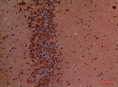Fig.3. Immunohistochemical analysis of paraffin-embedded Mouse-brain, antibody was diluted at 1:100.