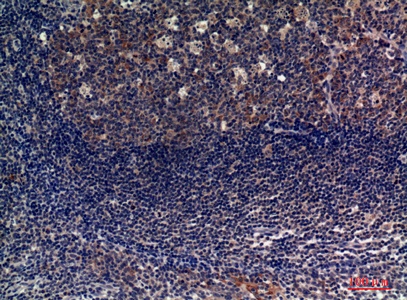 Fig.2. Immunohistochemical analysis of paraffin-embedded human-tonsils, antibody was diluted at 1:100.