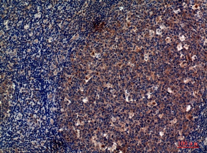 Fig.2. Immunohistochemical analysis of paraffin-embedded human-tonsils, antibody was diluted at 1:100.
