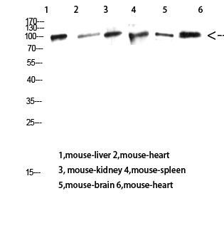 Fig.4. Western Blot analysis of Mouse-liver Mouse-heart Mouse-kidney Mouse-spleen Mouse-brain Mouse-heart using CD13 Polyclonal Antibody diluted at 1:1000. Secondary antibody (catalog#: A21020) was diluted at 1:20000.