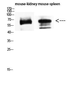 Fig.7. Western Blot analysis of Mouse-kidney Mouse-spleen using CD19 Polyclonal Antibody diluted at 1:1500. Secondary antibody (catalog#: A21020) was diluted at 1:20000.