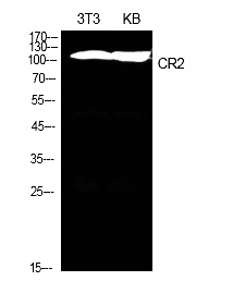 Fig.1. Western Blot analysis of NIH-3T3, KB cells using CD21 Polyclonal Antibody. Secondary antibody (catalog#: A21020) was diluted at 1:20000.