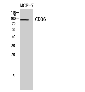 Fig. Western Blot analysis of MCF7, 4T1 cells using CD36 Polyclonal Antibody. Secondary antibody (catalog#: A21020) was diluted at 1:20000.