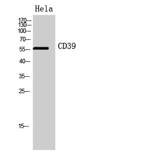 Fig. Western Blot analysis of hela cells using CD39 Polyclonal Antibody. Secondary antibody (catalog#: A21020) was diluted at 1:20000.