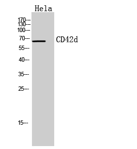 Fig.1. Western Blot analysis of hela cells using CD42d Polyclonal Antibody. Secondary antibody (catalog#: A21020) was diluted at 1:20000.