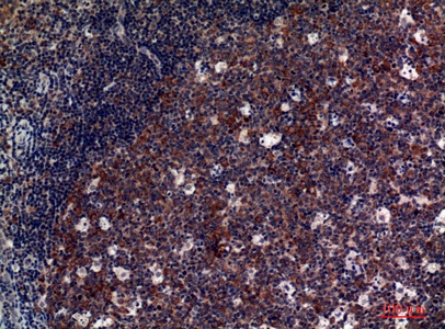 Fig.2. Immunohistochemical analysis of paraffin-embedded human-tonsils, antibody was diluted at 1:100.