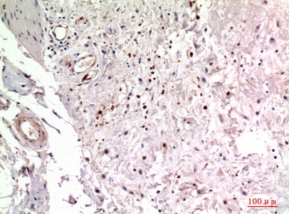 Fig.3. Immunohistochemical analysis of paraffin-embedded human-colon, antibody was diluted at 1:100.