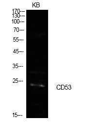 Fig.1. Western Blot analysis of KB cells using CD53 Polyclonal Antibody. Secondary antibody (catalog#: A21020) was diluted at 1:20000.