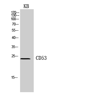 Fig.2. Western Blot analysis of KB cells using CD53 Polyclonal Antibody. Secondary antibody (catalog#: A21020) was diluted at 1:20000.