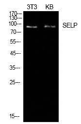 Fig.1. Western Blot analysis of NIH-3T3, KB cells using P-Selectin Polyclonal Antibody. Secondary antibody (catalog#: A21020) was diluted at 1:20000.