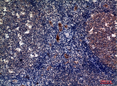 Fig.3. Immunohistochemical analysis of paraffin-embedded human-tonsils, antibody was diluted at 1:100.