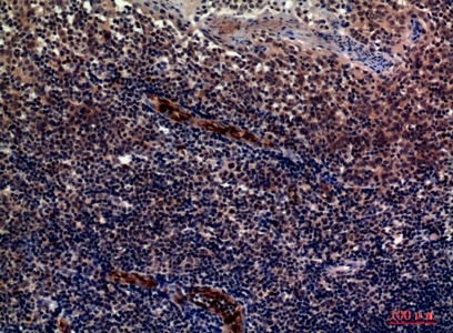 Fig.4. Immunohistochemical analysis of paraffin-embedded human-tonsils, antibody was diluted at 1:100.