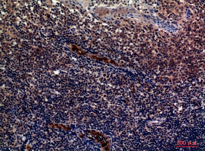 Fig.4. Immunohistochemical analysis of paraffin-embedded human-tonsils, antibody was diluted at 1:100.