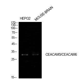 Fig.1. Western Blot analysis of HepG2,  Mouse brain cells using CD66c/d Polyclonal Antibody. Antibody was diluted at 1:1000. Secondary antibody (catalog#: A21020) was diluted at 1:20000.
