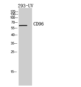 Fig.2. Western Blot analysis of 293-UV cells using CD96 Polyclonal Antibody diluted at 1:500. Secondary antibody (catalog#: A21020) was diluted at 1:20000.