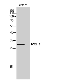 Fig. Western Blot analysis of MCF7, HepG2 cells using ICAM-2 Polyclonal Antibody. Secondary antibody (catalog#: A21020) was diluted at 1:20000.