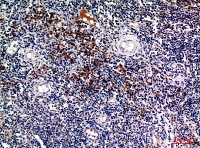 Fig.2. Immunohistochemical analysis of paraffin-embedded human-tonsils, antibody was diluted at 1:100.