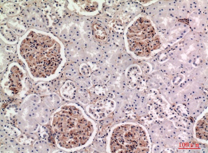 Fig.2. Immunohistochemical analysis of paraffin-embedded human-kidney, antibody was diluted at 1:100.