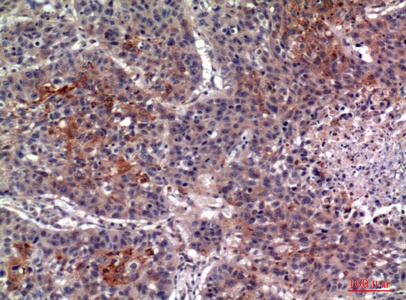 Fig.3. Immunohistochemical analysis of paraffin-embedded human-lung, antibody was diluted at 1:100.
