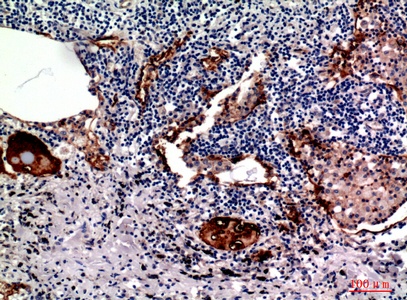 Fig.4. Immunohistochemical analysis of paraffin-embedded human-lung, antibody was diluted at 1:100.