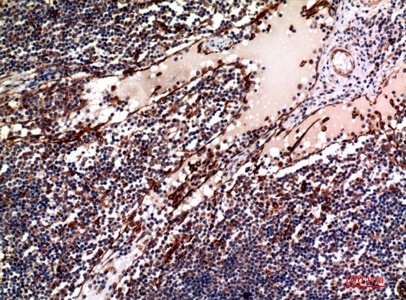 Fig.3. Immunohistochemical analysis of paraffin-embedded human-lymph, antibody was diluted at 1:100.