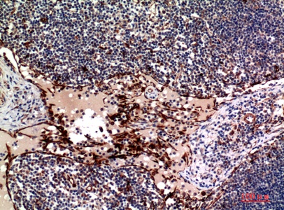 Fig.4. Immunohistochemical analysis of paraffin-embedded human-lymph, antibody was diluted at 1:100.