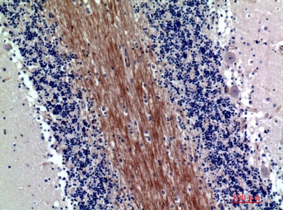 Fig.2. Immunohistochemical analysis of paraffin-embedded human-brain, antibody was diluted at 1:200.