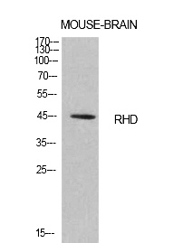 Fig.1. Western Blot analysis of Mouse brain cells using CD240d Polyclonal Antibody. Antibody was diluted at 1:1000. Secondary antibody (catalog#: A21020) was diluted at 1:20000.