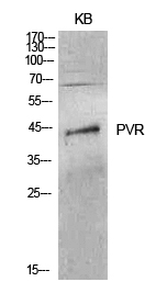 Fig.1. Western Blot analysis of KB cells using CD155 Polyclonal Antibody. Secondary antibody (catalog#: A21020) was diluted at 1:20000.