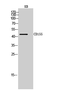Fig.2. Western Blot analysis of KB cells using CD155 Polyclonal Antibody. Secondary antibody (catalog#: A21020) was diluted at 1:20000.