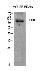 Fig.1. Western Blot analysis of Mouse brain cells using CD180 Polyclonal Antibody. Antibody was diluted at 1:1000. Secondary antibody (catalog#: A21020) was diluted at 1:20000.