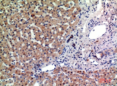Fig.2. Immunohistochemical analysis of paraffin-embedded human-liver, antibody was diluted at 1:200.
