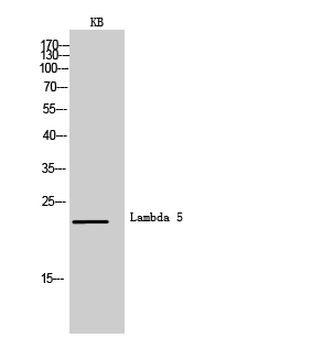 Fig.1. Western Blot analysis of KB cells using Lambda 5 Polyclonal Antibody. Secondary antibody (catalog#: A21020) was diluted at 1:20000.
