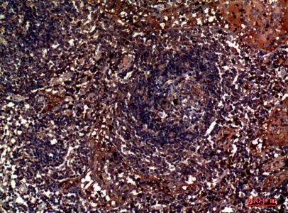 Fig.2. Immunohistochemical analysis of paraffin-embedded human-lymph, antibody was diluted at 1:100.