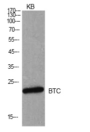 Fig.1. Western Blot analysis of KB cells using Probetacellulin Polyclonal Antibody. Secondary antibody (catalog#: A21020) was diluted at 1:20000.
