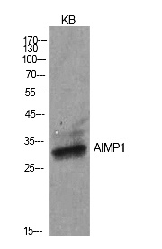 Fig.1. Western Blot analysis of KB cells using EMAP II Polyclonal Antibody. Secondary antibody (catalog#: A21020) was diluted at 1:20000.