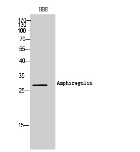 Fig. Western Blot analysis of HBE cells using Amphiregulin Polyclonal Antibody. Secondary antibody (catalog#: A21020) was diluted at 1:20000.