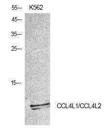 Fig.1. Western Blot analysis of K562 cells using MIP-1b Polyclonal Antibody. Antibody was diluted at 1:500. Secondary antibody (catalog#: A21020) was diluted at 1:20000.